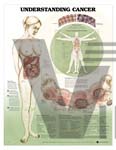 Understanding Cancer Anatomical Chart